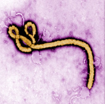 ebolavirus